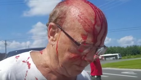 Pickup Truck Driver Attacks Cyclist With Club In Peterborough